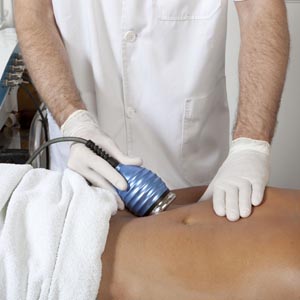 lipo cavitacio barcelona