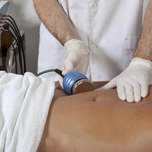 lipo cavitacio barcelona